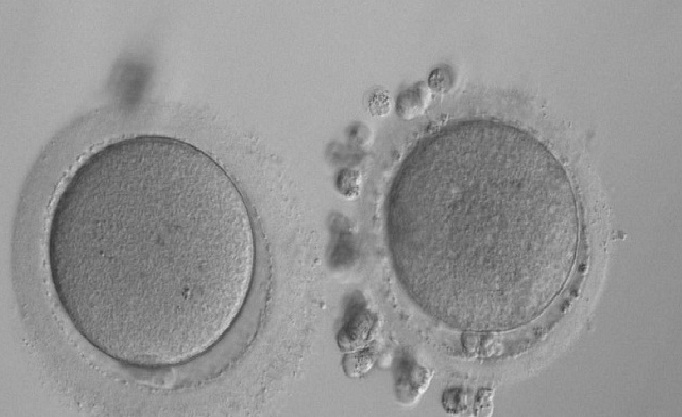 Oocyte Vitrification